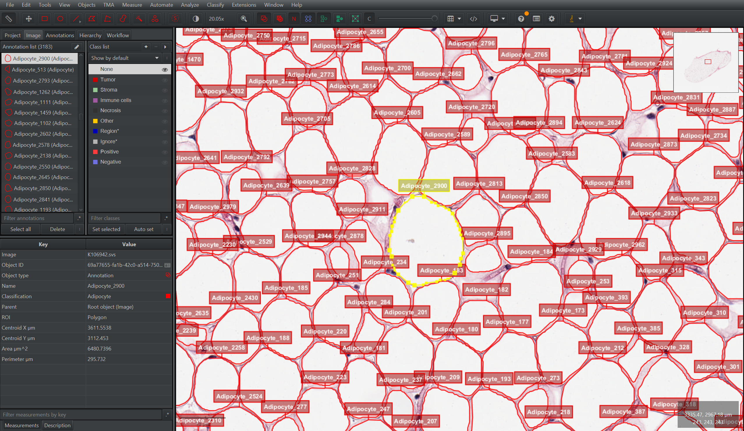 Zoomed QuPath view showing individual AdiFind adipocyte annotations.