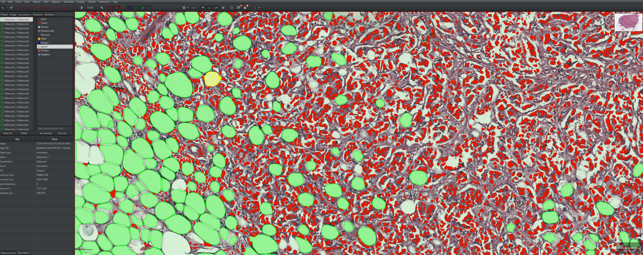 QuPath view showing AdiFind adipocyte masks in light green together with StarDist nuclei detections in red.