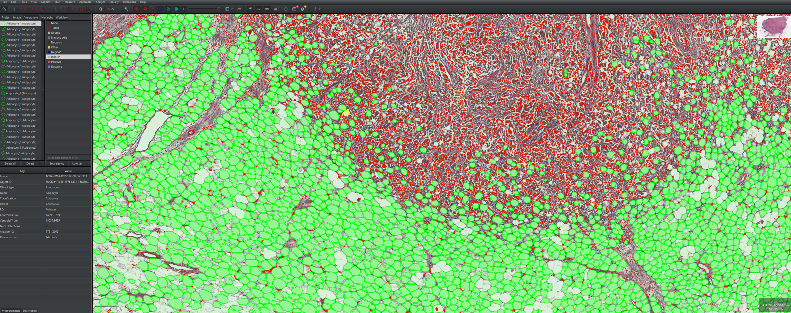 Zoomed-out QuPath view showing AdiFind adipocyte masks in light green together with StarDist nuclei detections in red.