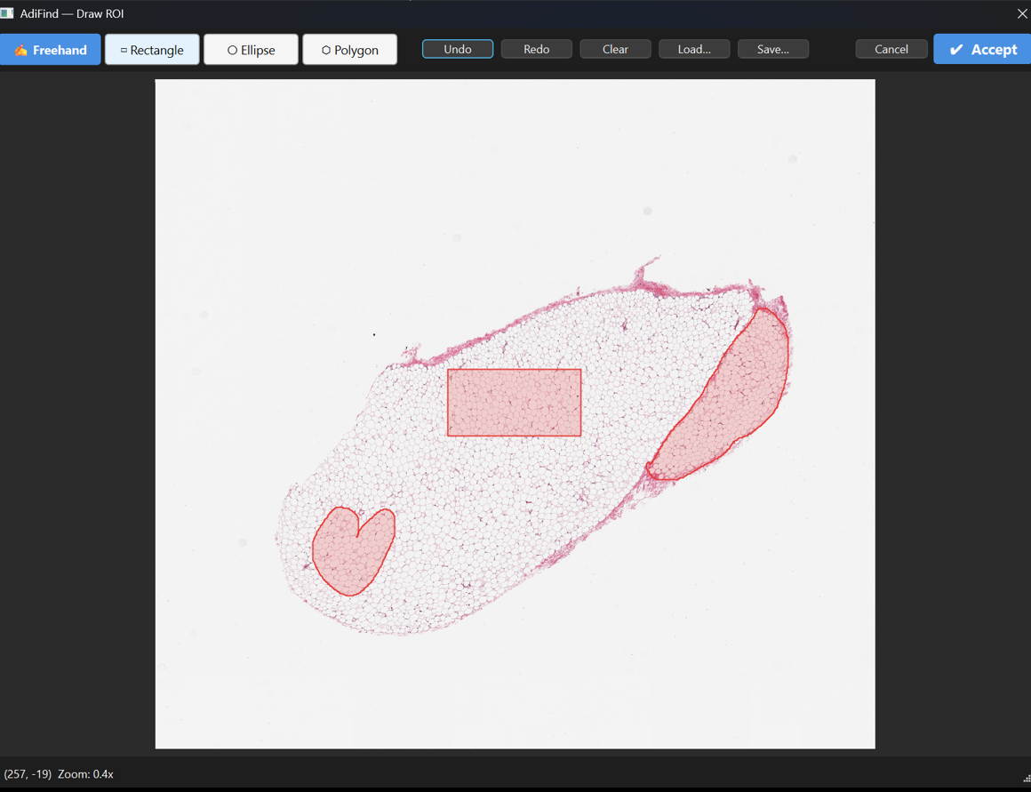 Freehand ROI selection before annotations are applied.